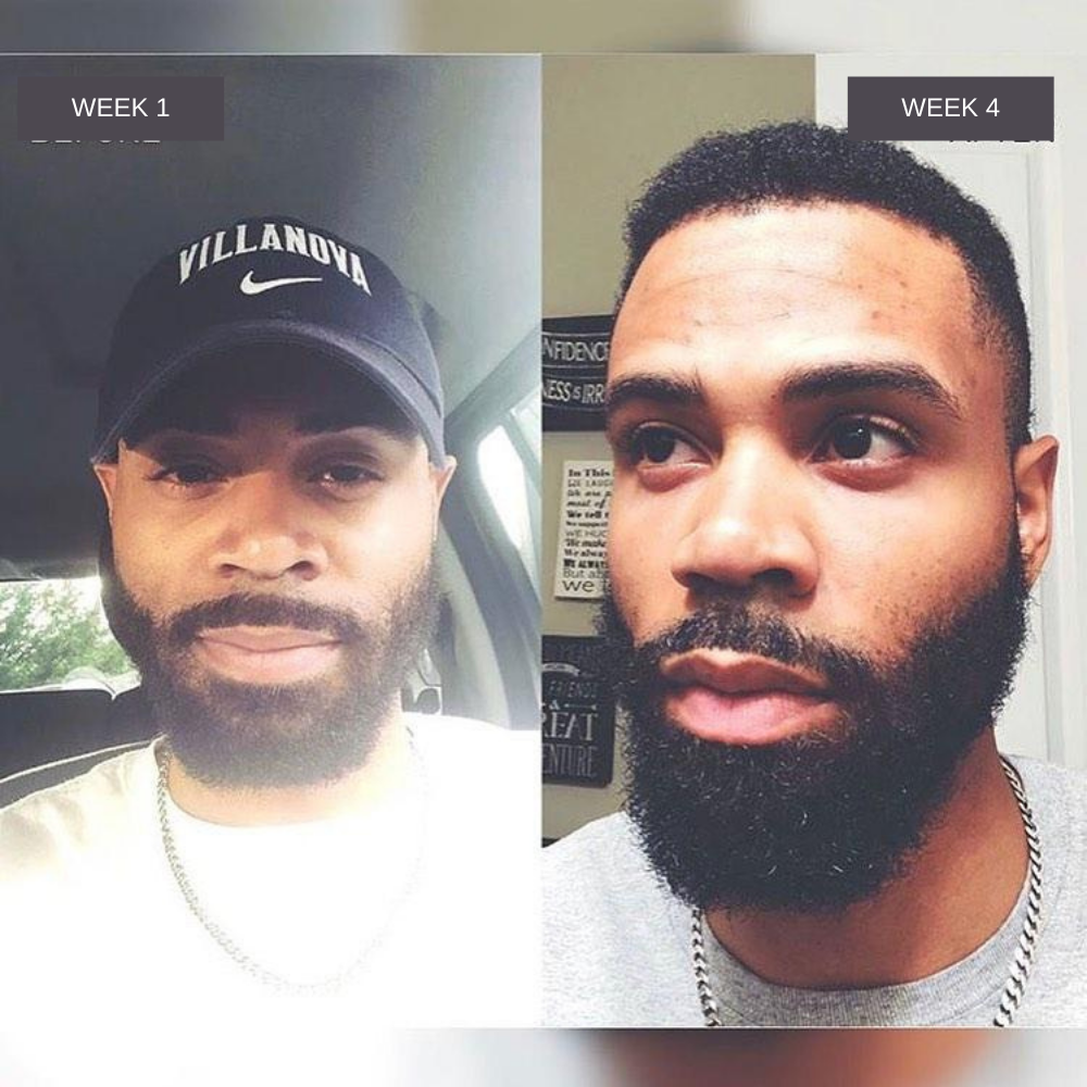 Beard Oil & Gummy Vitamins - Faster Beard Growth & Grooming Bundle